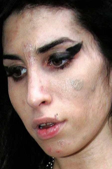 Amy Winehouse Bad Skin