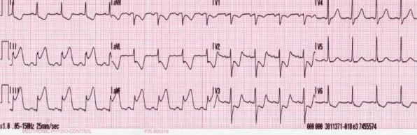 EKG-1.jpg