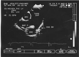 Cnngngmch001.png picture by giangduongykhoa