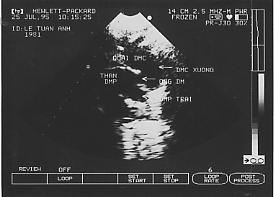 Cnngngmch003.png picture by giangduongykhoa