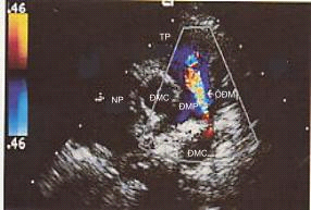 Cnngngmch005.png picture by giangduongykhoa