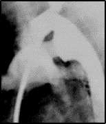 Cnngngmch007.png picture by giangduongykhoa