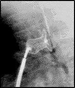 Cnngngmch009.png picture by giangduongykhoa