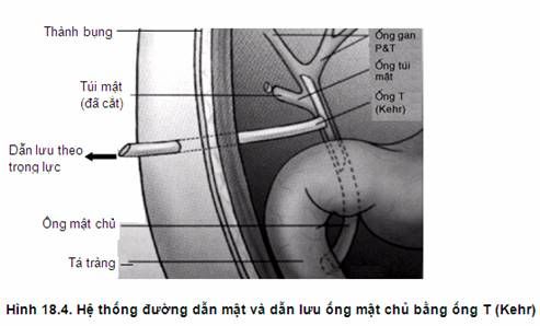 http://i17.photobucket.com/albums/b83/giangduongykhoa/bai%20giang/Bai%20giang%20cu%20nhan%20dieu%20duong/image089.jpg?t=1299434823