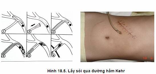 http://i17.photobucket.com/albums/b83/giangduongykhoa/bai%20giang/Bai%20giang%20cu%20nhan%20dieu%20duong/image090.jpg?t=1299434826