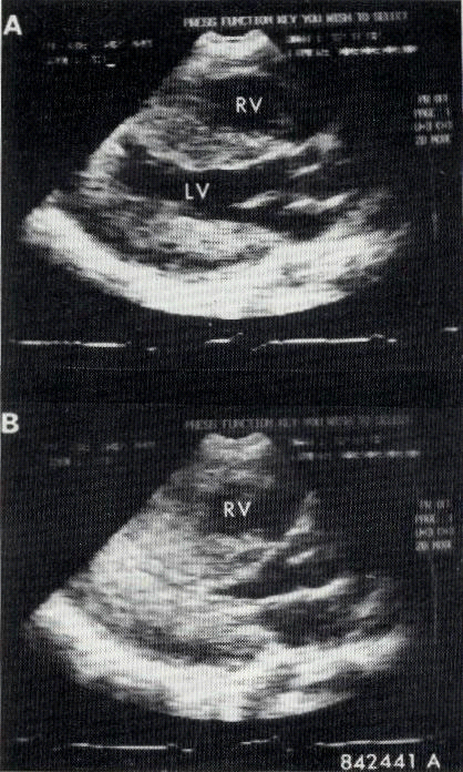 image003-3.png picture by giangduongykhoa