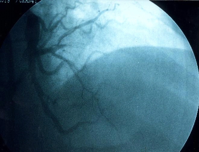 image005-5.png picture by giangduongykhoa