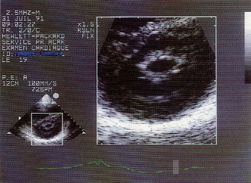 image007-3.png picture by giangduongykhoa