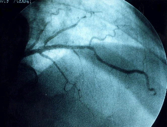 image007-5.png picture by giangduongykhoa