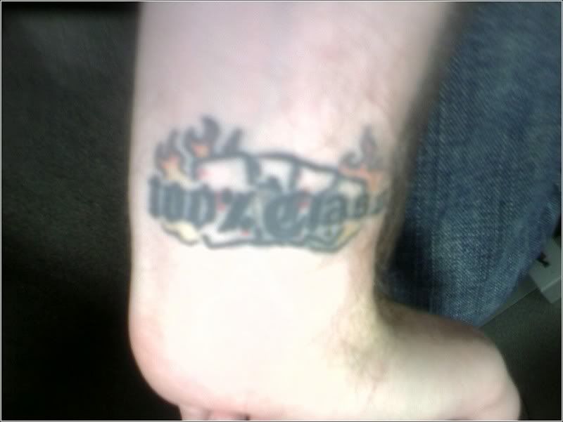 https://i17.photobucket.com/albums/b84/kcos45/wrist.jpg